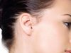 Costo per otoplastica Milano