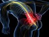 Trattamento ozonoterapia Roma